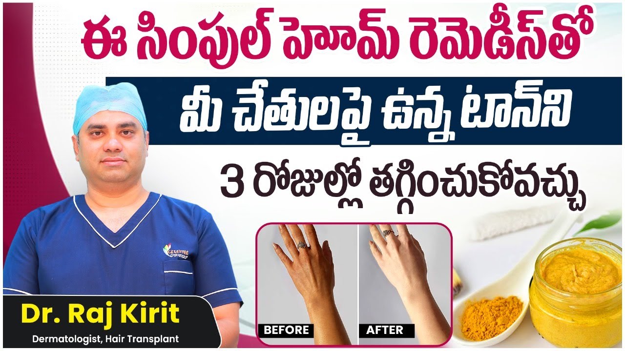 How To Remove Tan From Hands Instantly | Tan Removal Home Remedies For Hands And Legs | Celestee