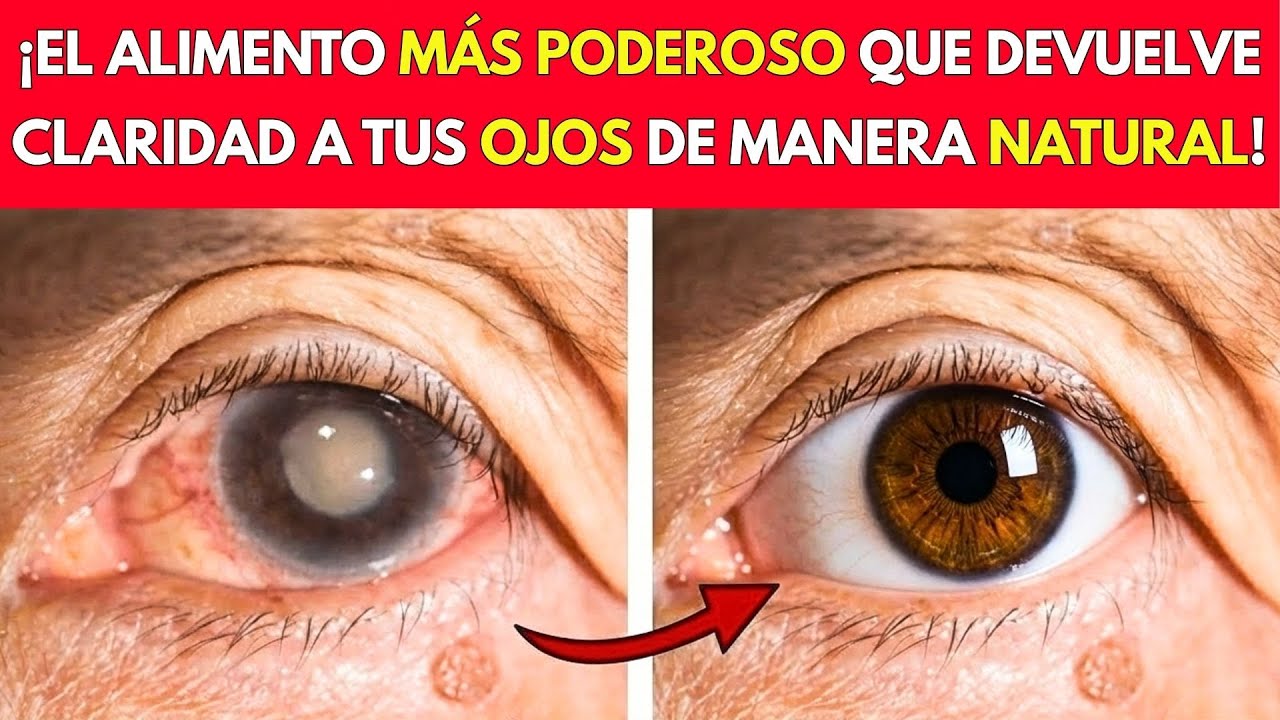 ¡VISIÓN BORROSA? ESTE ALIMENTO BARATO Y PODEROSO ACLARA TU VISTA EN SEMANAS!