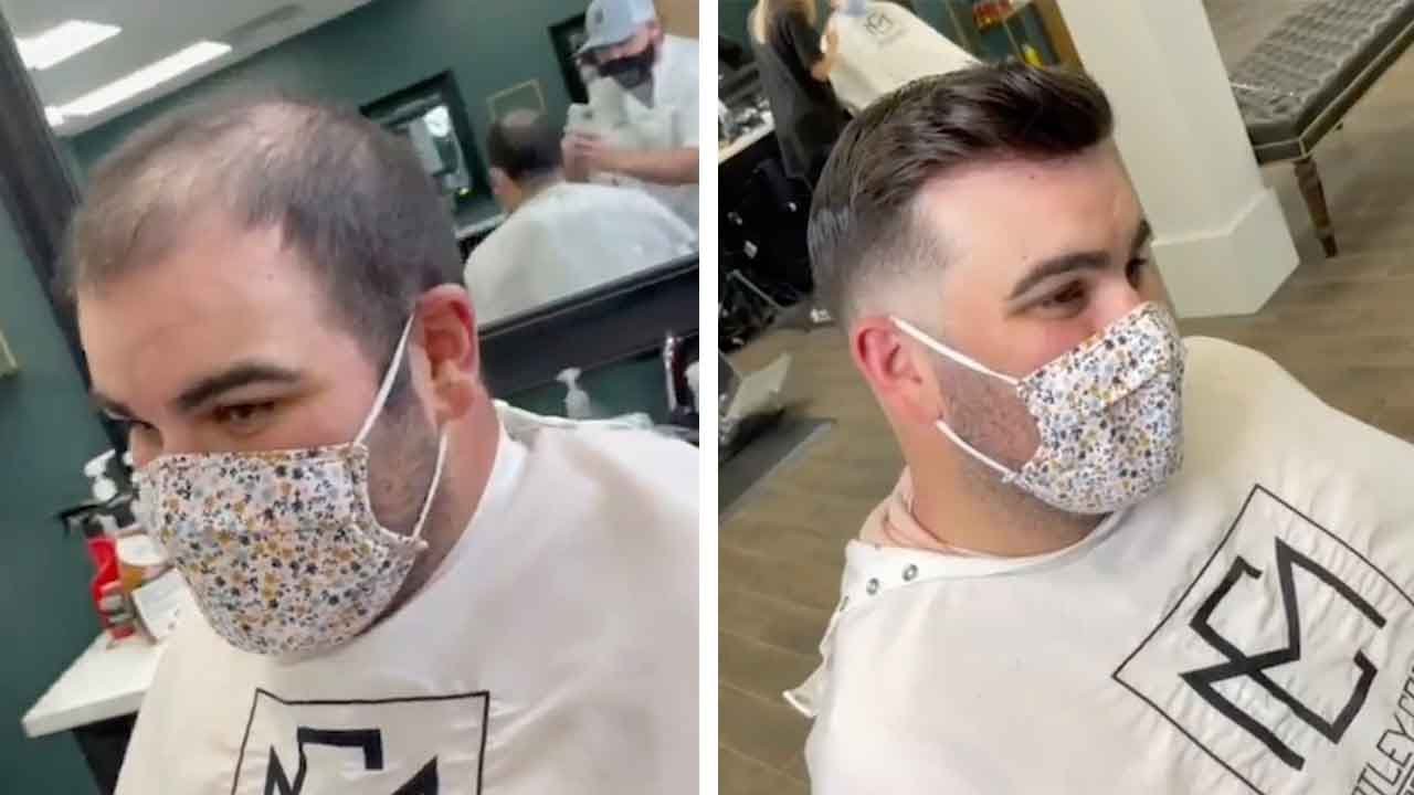 Skilful Barber Gives Brand-New Hair To Bald Men