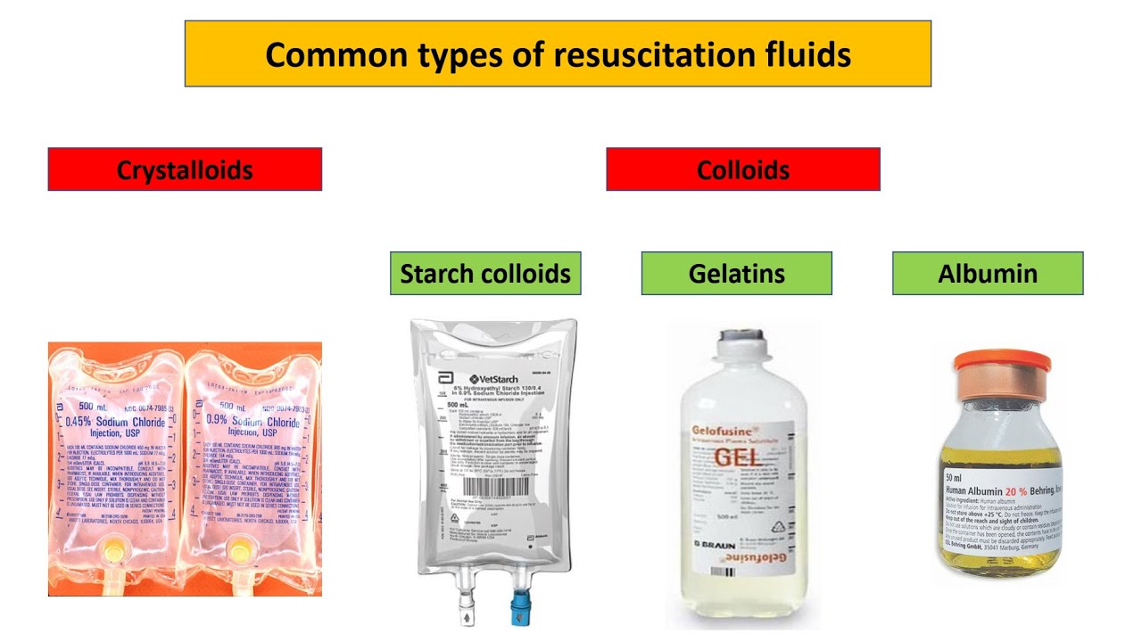 How should I choose the appropriate intravenous fluid in my patient?