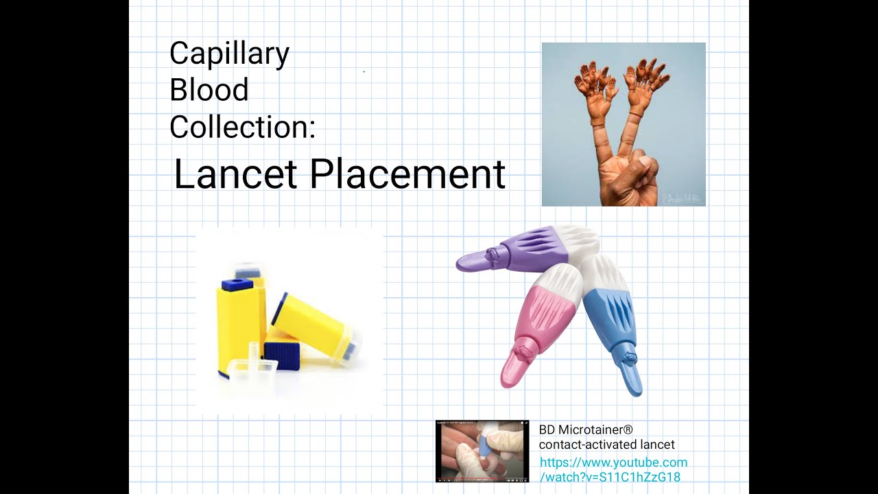 Capillary Blood Collection: Lancet Placement for Finger Poke