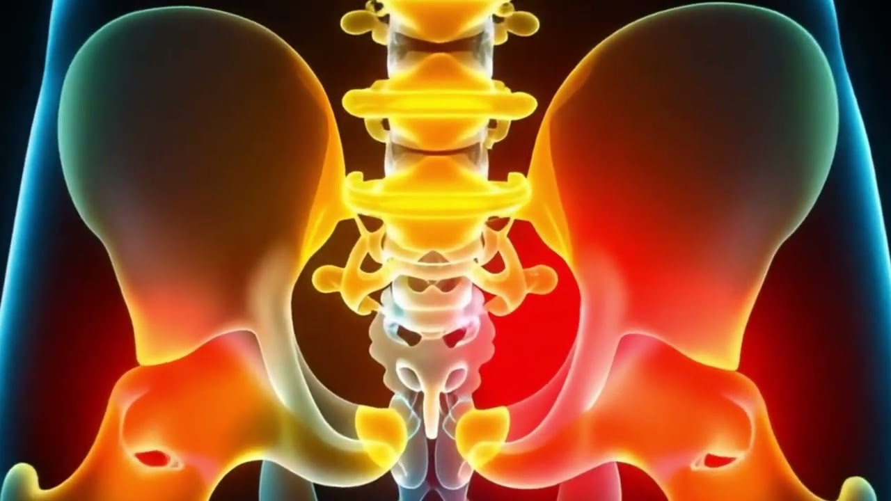 Sciatica Healing - Miracle Rife Frequency | Sciatica Rife Treatment |  Isochronic Binaural Beats