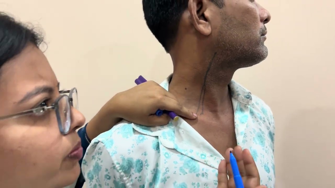 jugular veins surface markings