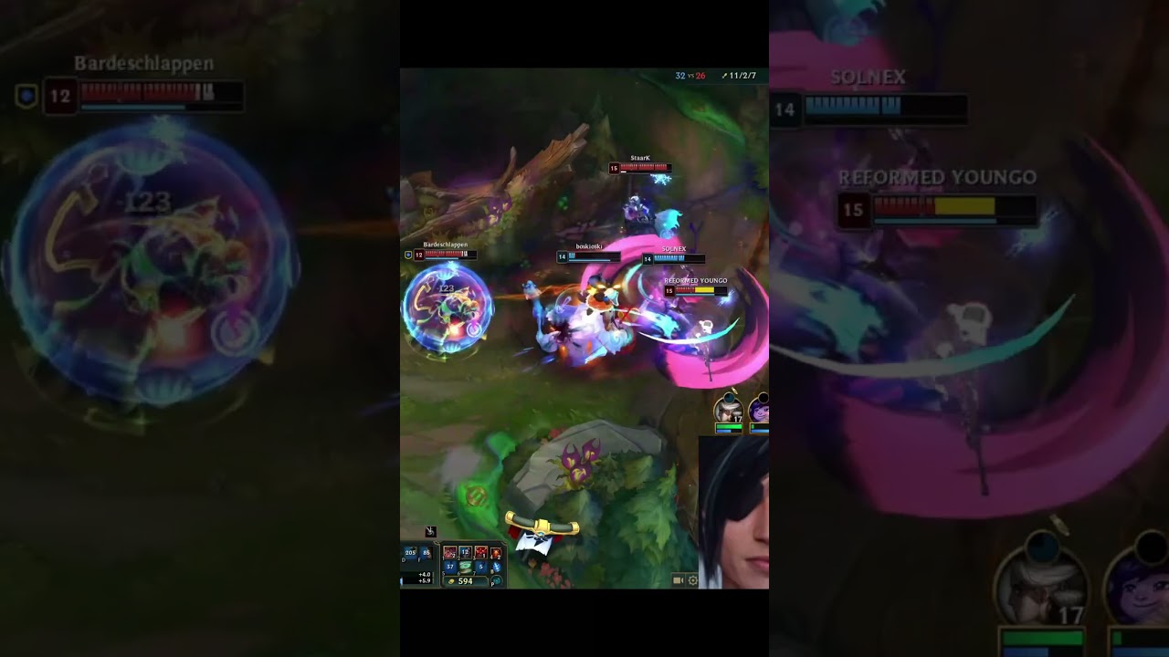 Difference between ADC and Support | Drututt