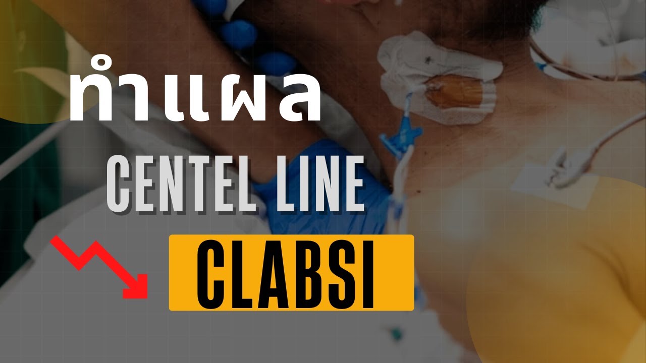 การทำความสะอาด Central line