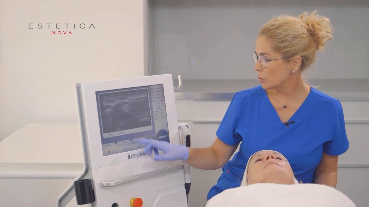 Jak wygląda zabieg HIFU - ULTRASKIN II? Estetica Nova