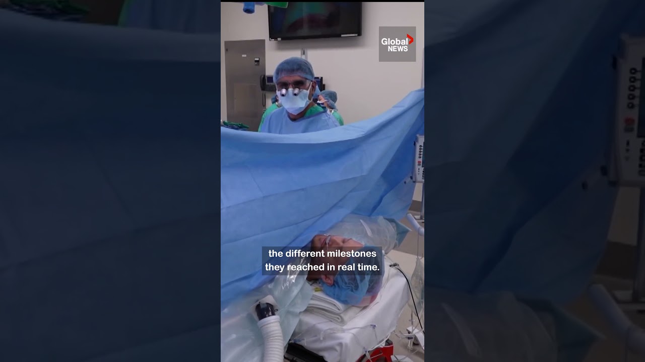 1st kidney transplant performed with patient wide awake 🩺