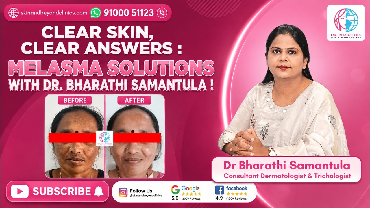 Melasma Treatment Explained | Clear Skin Solutions by Dr. Bharathi Samantula