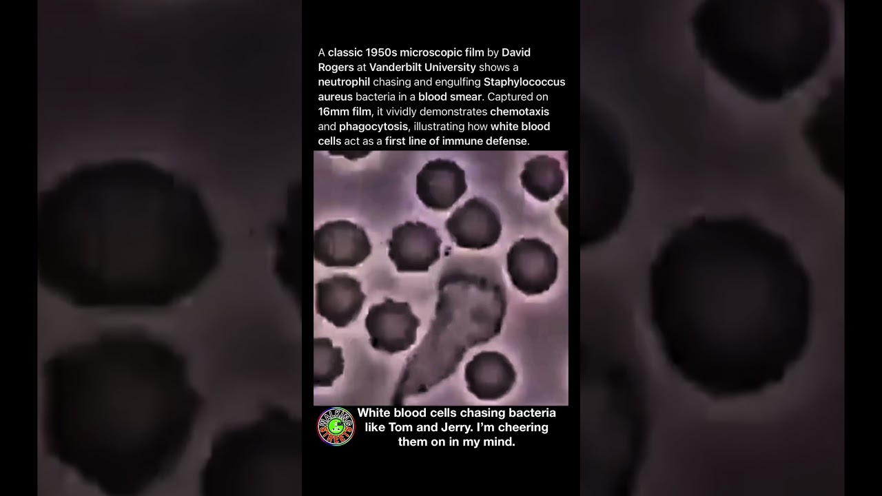 Immune Defense In Action As A White Blood Cell Pursues And Engulfs Staphylococcus Bacteria On Film