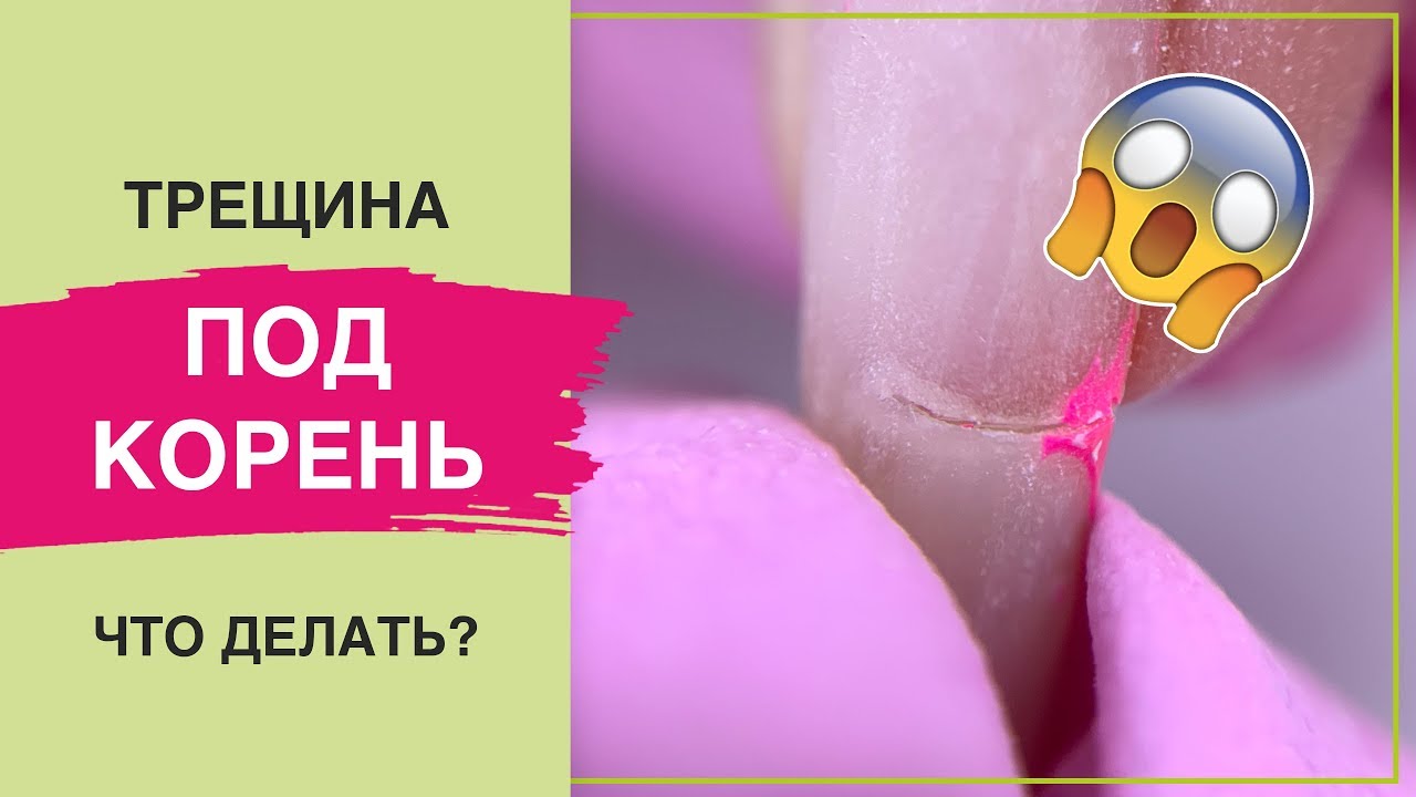 Быстрый РЕМОНТ ТРЕЩИНЫ файберглассом и гель-лаком