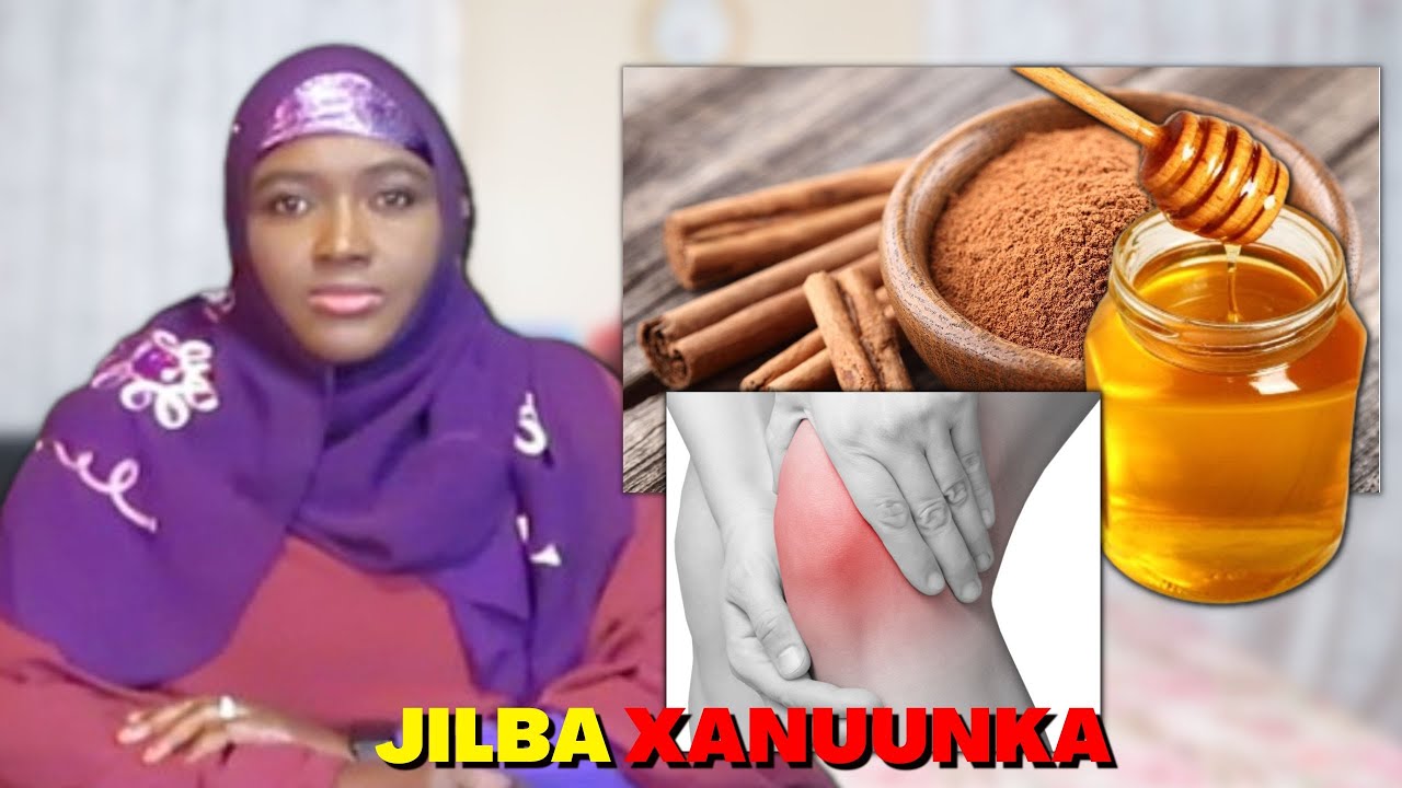 CAJIIB QORFAHA IYO MALABKA! DAWO DABIICI AH UFIICAN DARYEEL JILBA XANUUNKA!