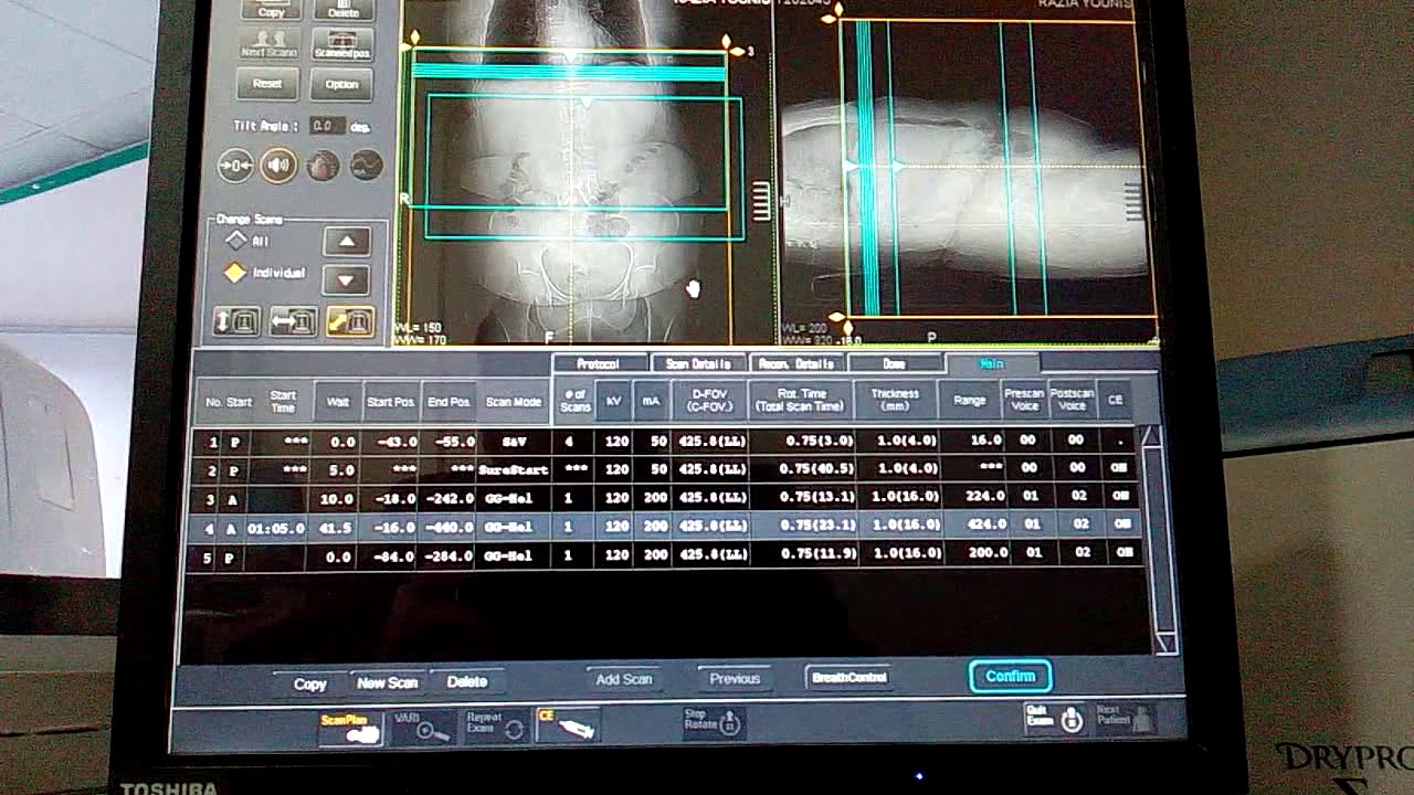 #Triphasicabdomen #Triphasicliver #Protocols #Arterial #Venous #Delayedphase