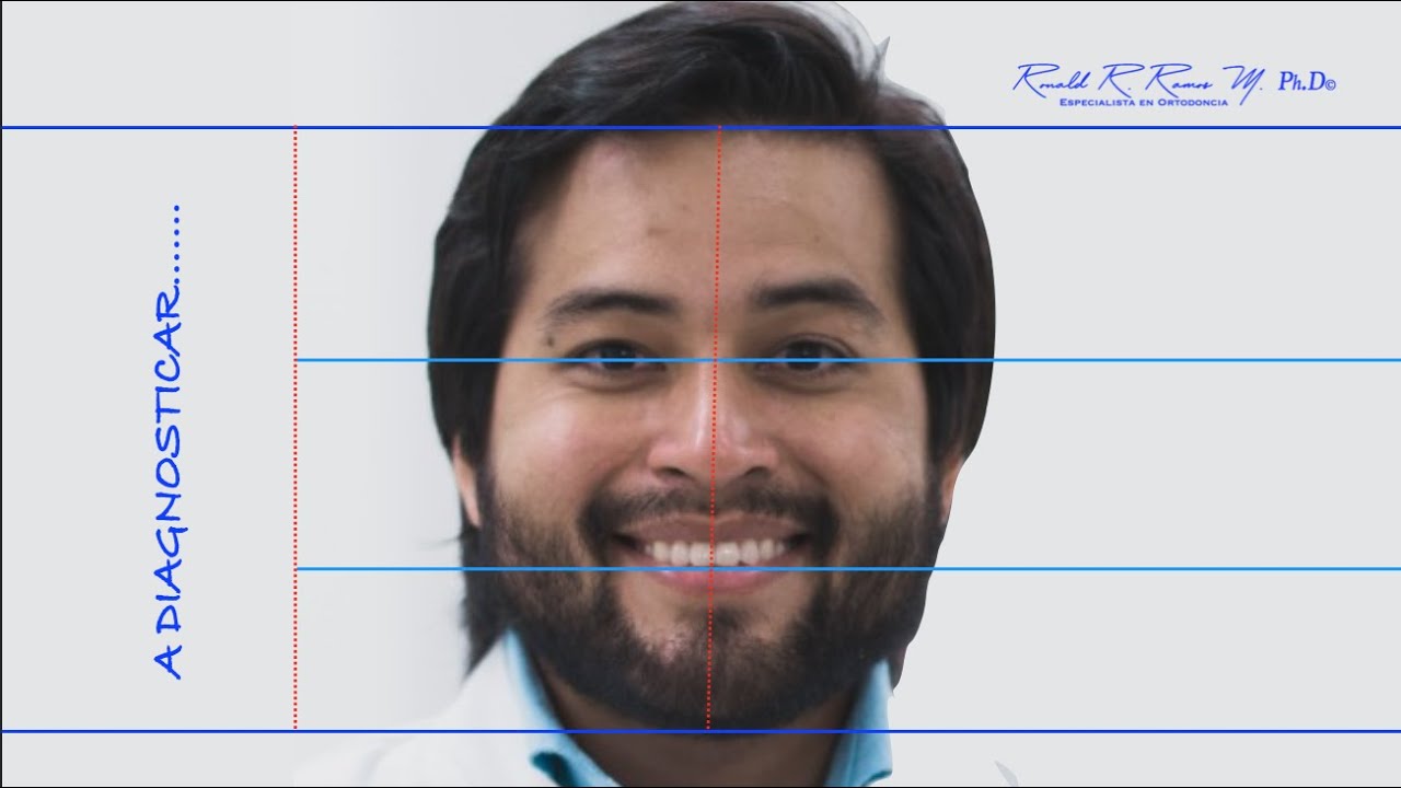 ANÁLISIS DE PROPORCIONES FACIALES EN POWER POINT