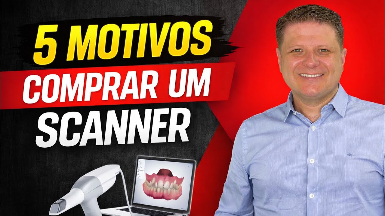 05 MOTIVOS para você comprar um SCANNER