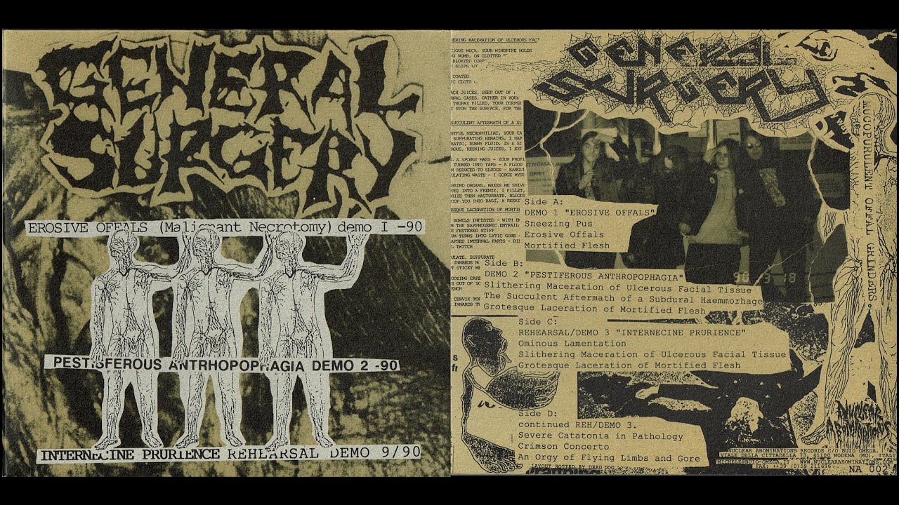 General Surgery - Demos Compilation (Swedish Goregrind)