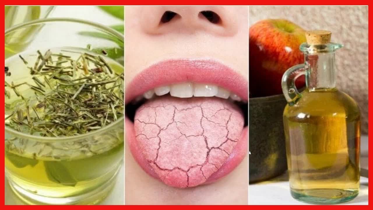 5 Hausmittel gegen Mundtrockenheit
