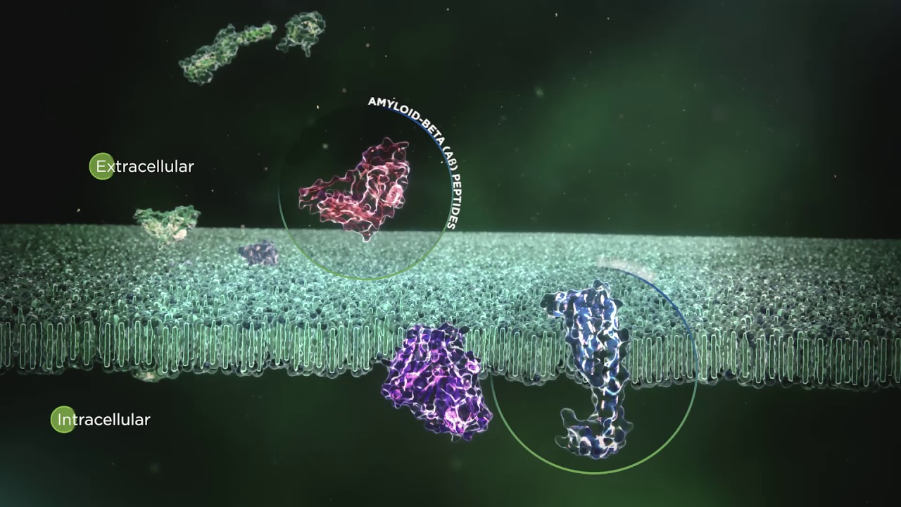Mechanism of Disease: Alzheimer’s