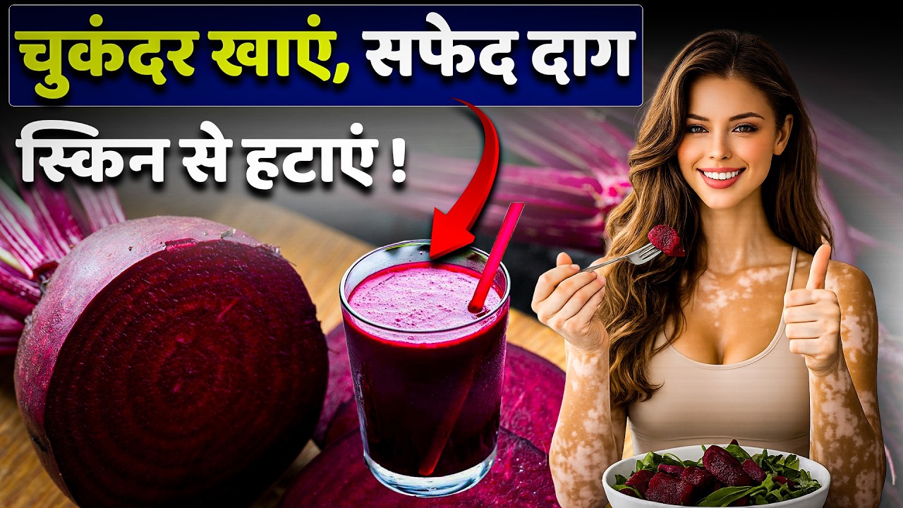 चुकंदर खाएं सफेद दाग स्किन से हटाएं || Eat beetroot to remove white patches from your skin
