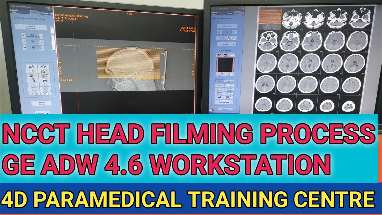 CT SCAN BRAIN PLAIN AND TRAUMATIC PATIENT FILMING PROCESS GE HEALTHINEERS ADW 4.6 WORKSTATION