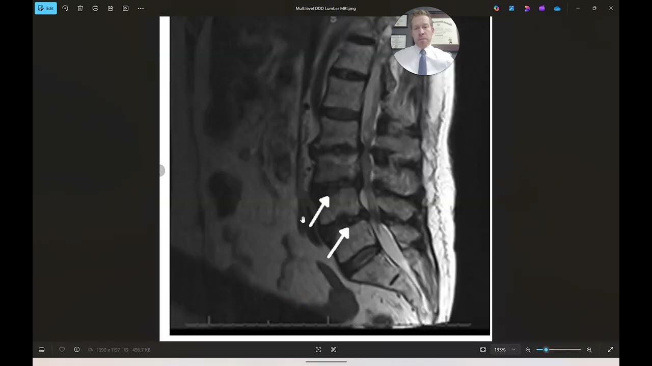 Half a Millimeter Can Be the Difference Between Life and Death or Pain and Misery