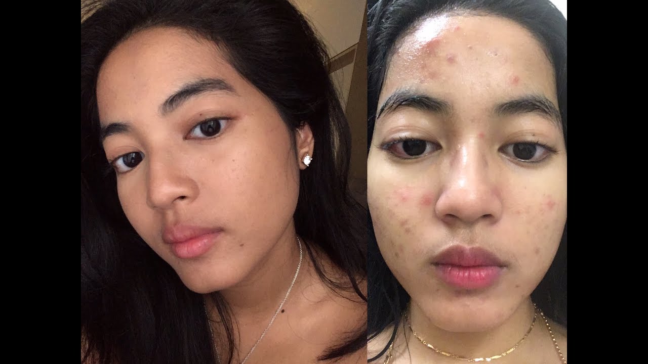 4 skincare steps you can’t skip. (Educational tutorial)