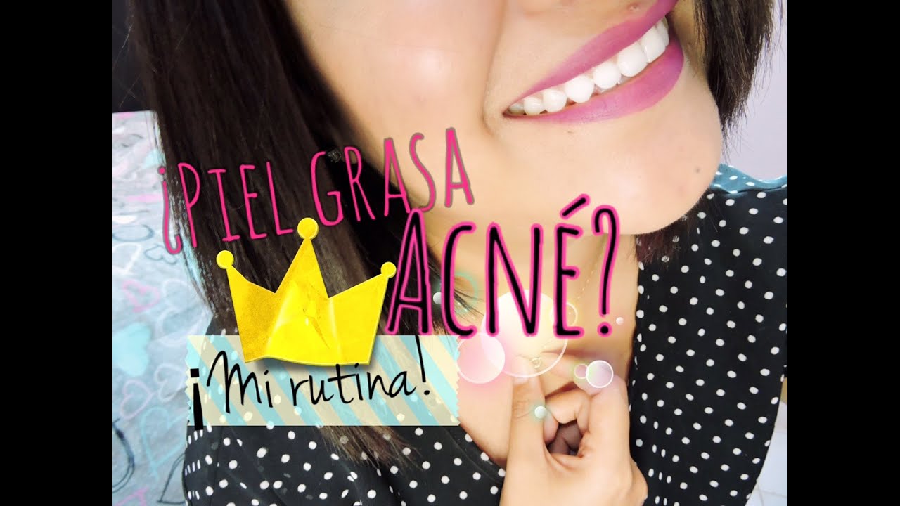 Mi rutina facial: Piel grasa con acné ♥ Anabel México