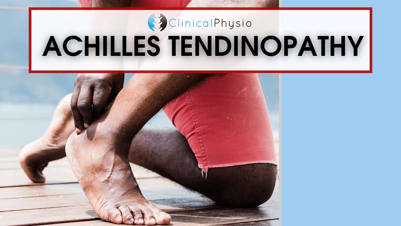 Achilles Tendinopathy | Best Physio Assessment and Treatment Tips!