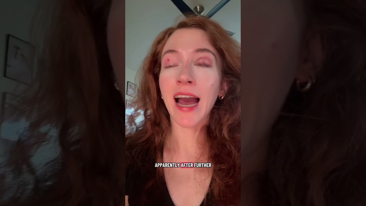 Redirected aggression is something that everyone should be aware of in cats! #catlovers #catstory