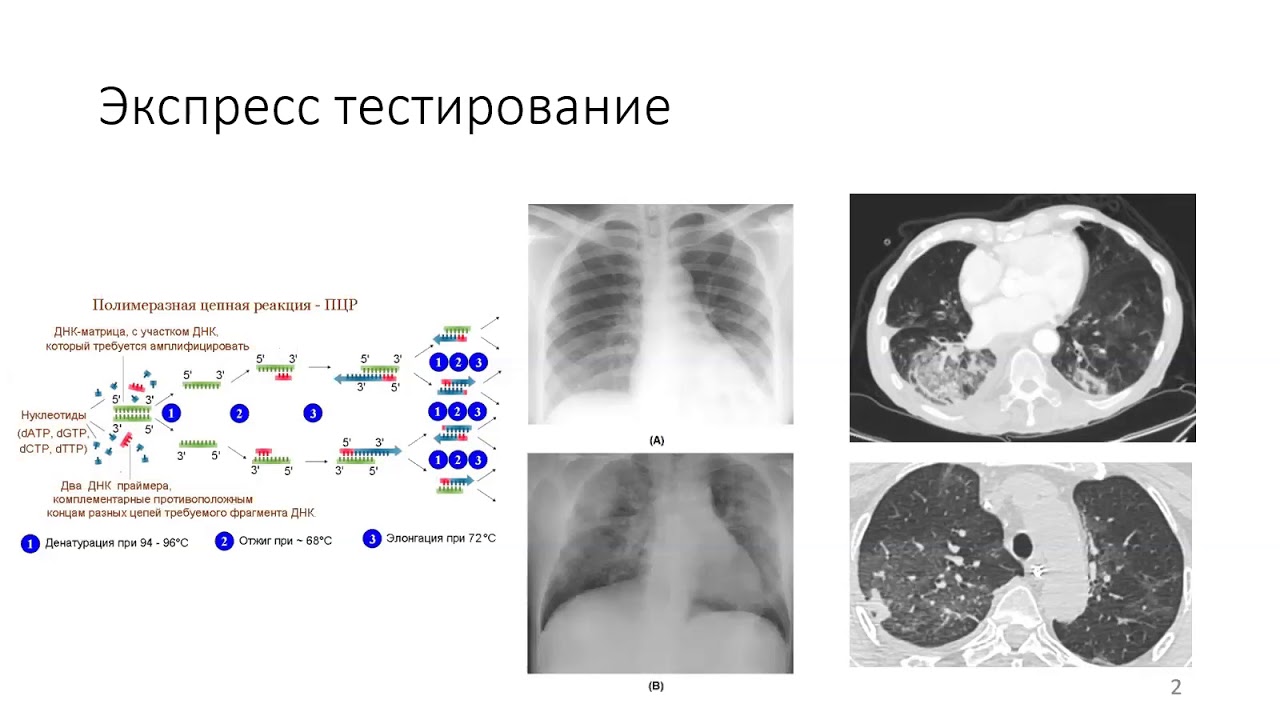 Sample-Efficient Deep Learning for COVID-19 Diagnosis Based on CT Scans