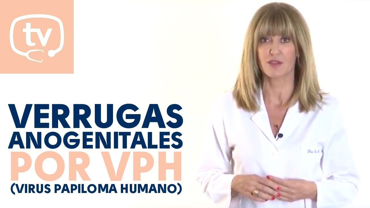 Verrugas anogenitales por el VPH (Virus Papiloma Humano)