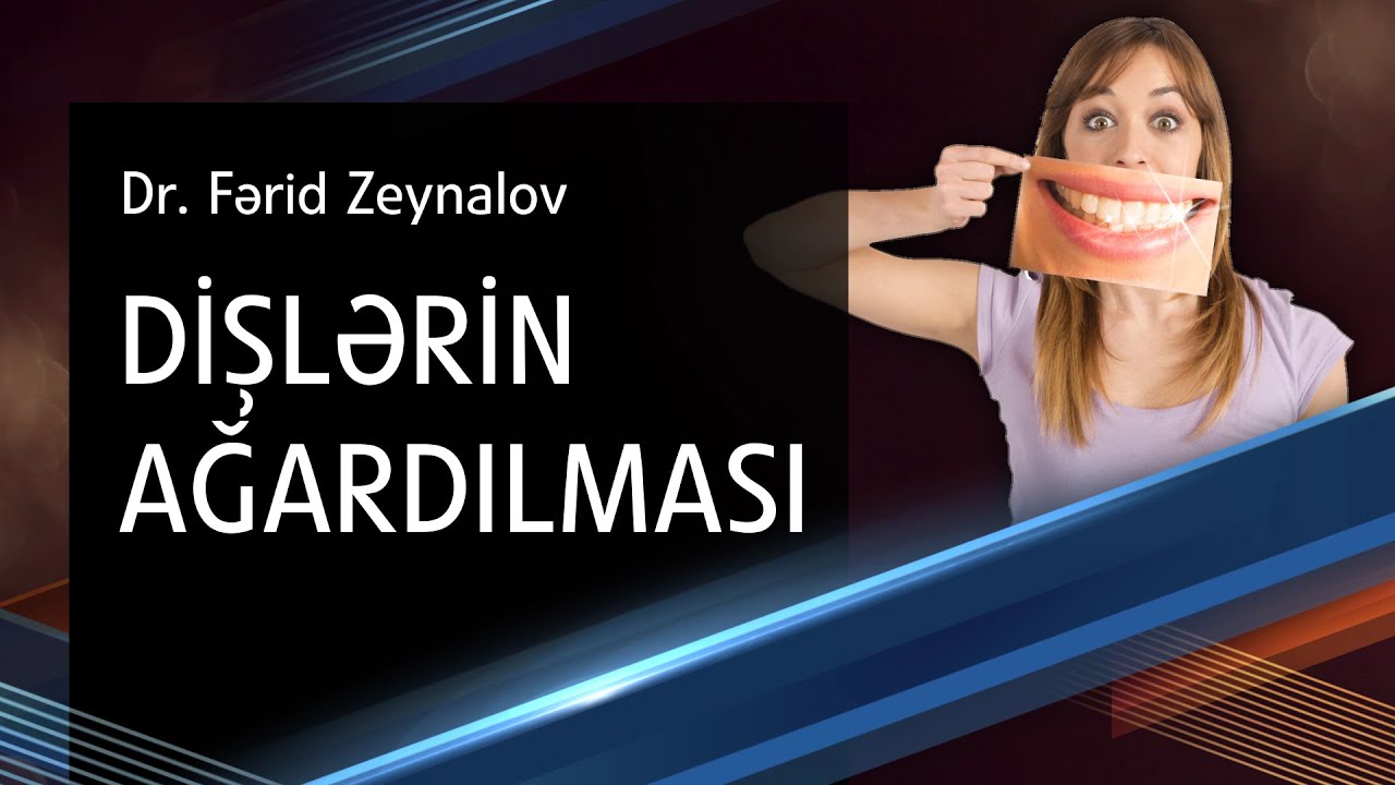 Dişlərin ağardılması - ən keyfiyyətli və təhlükəsiz üsullar - Stomatoloq məsləhəti (12)