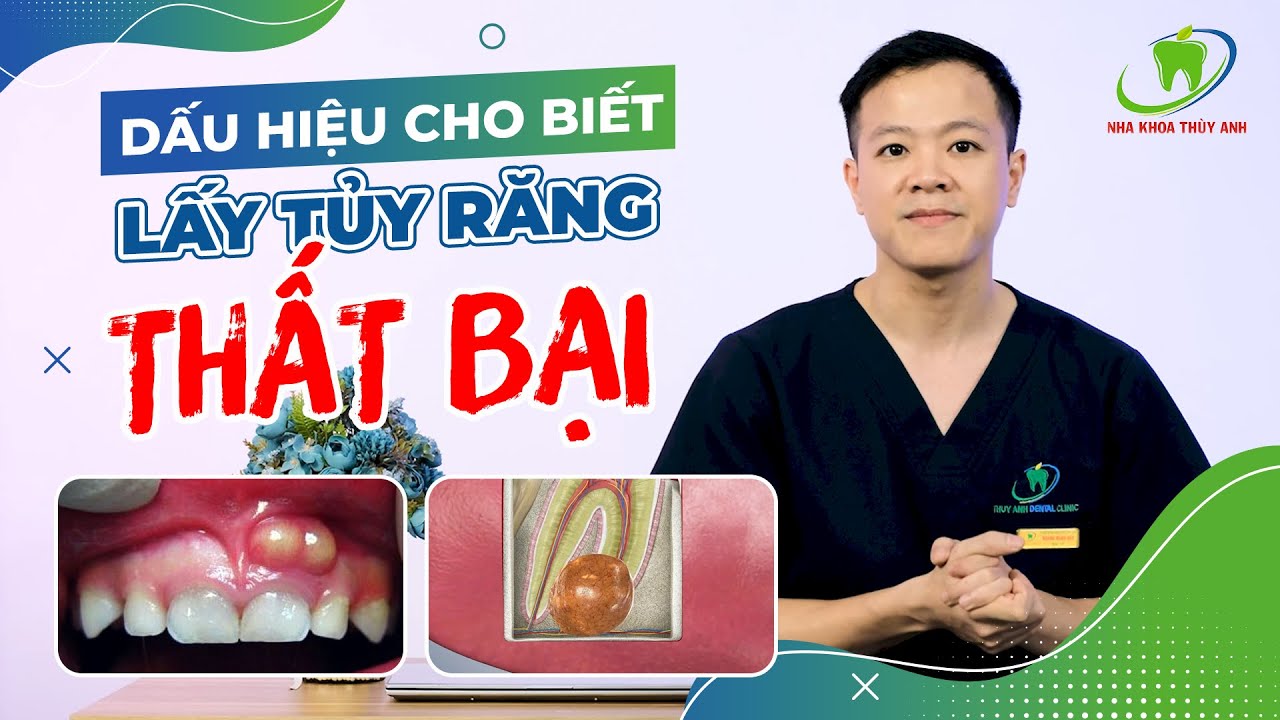 DẤU HIỆU CHO BẠN BIẾT ĐIỀU TRỊ TỦY RĂNG THẤT BẠI