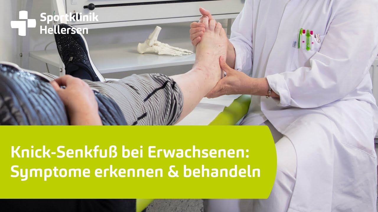 Knick-Senkfuß bei Erwachsenen: Symptome erkennen und richtig handeln