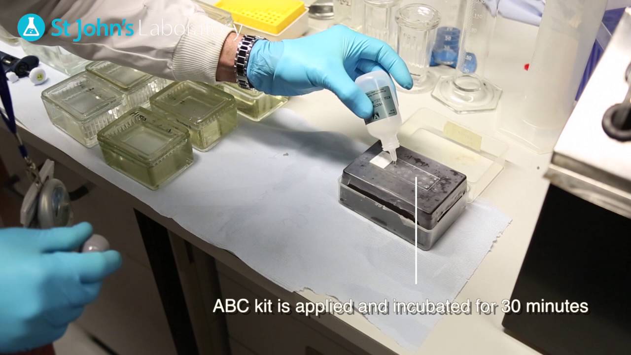 ImmunoHistoChemistry (IHC) - Video Protocol Series