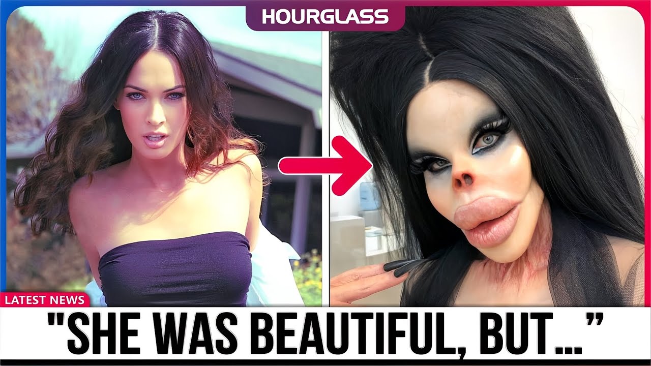 35 Shocking Celebrity Plastic Surgery Disasters | Then and Now 2025