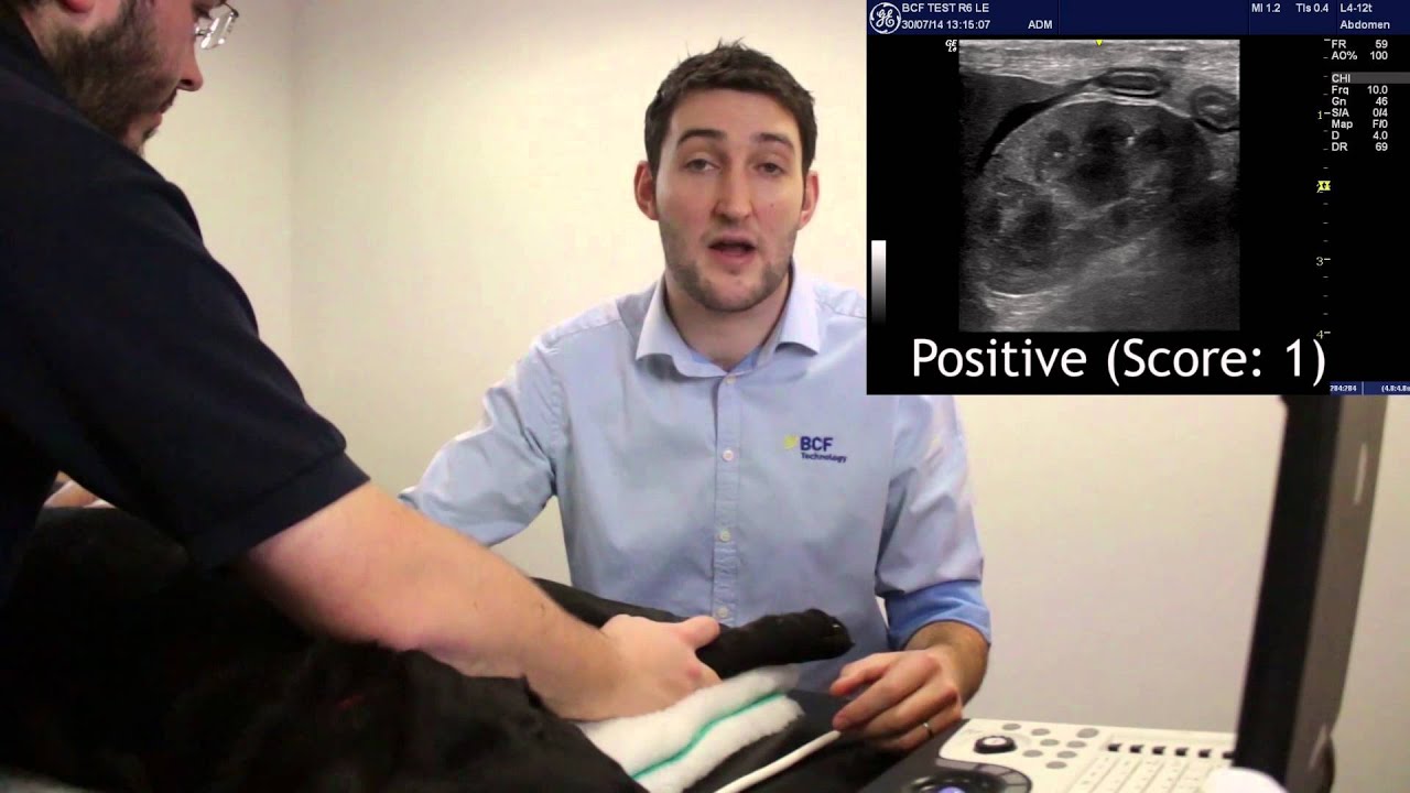 Abdominal Ultrasound FAST Scanning Techniques for Dogs Video 5 - Splenorenal View