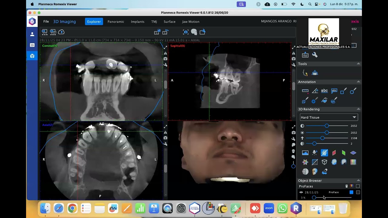bee DICOM viewer para MAC centro radiologico maxilar