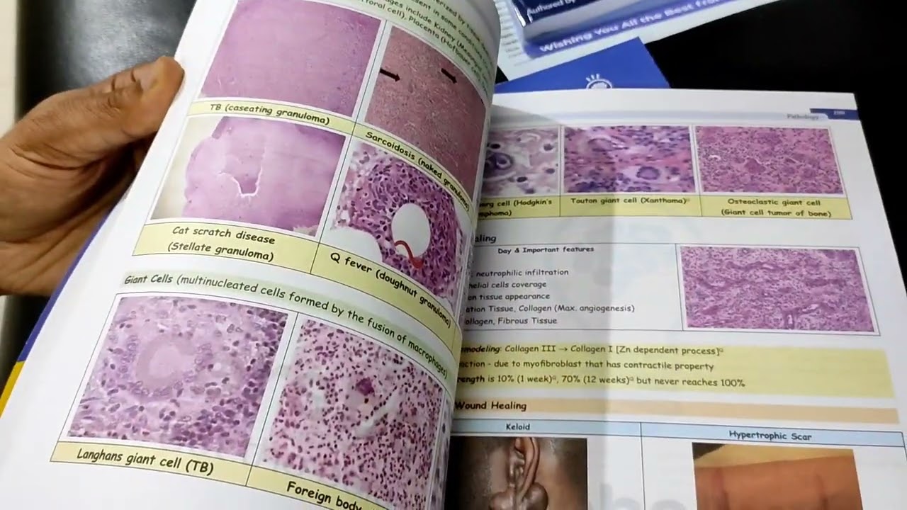 Cerebellum's Quick Revision Notes Unboxing video #cerebellumacademy #youtube #neetpg #exam #notes