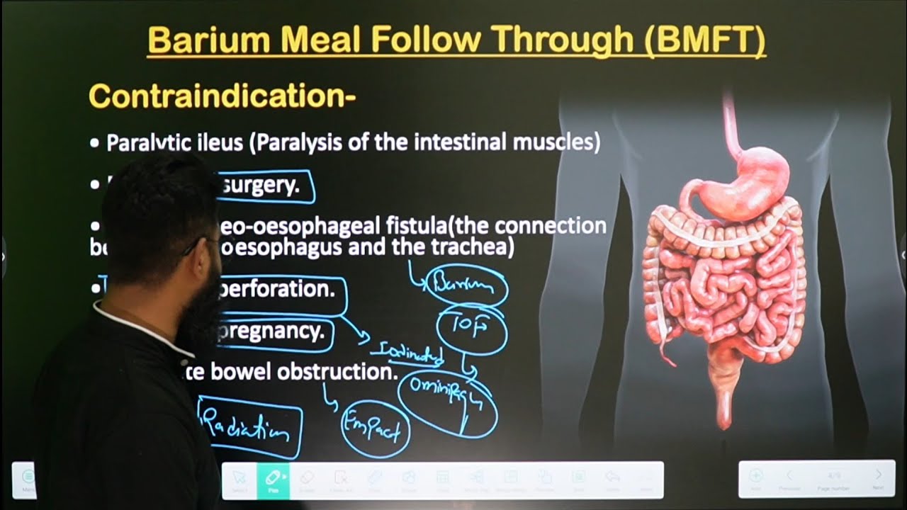 Barium Meal Follow Through (BMFT) || Part -1 || In Hindi || Radiology Procedure ||