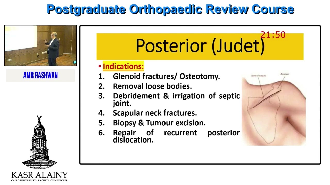 12  Shoulder Approaches   Amr Rashwan