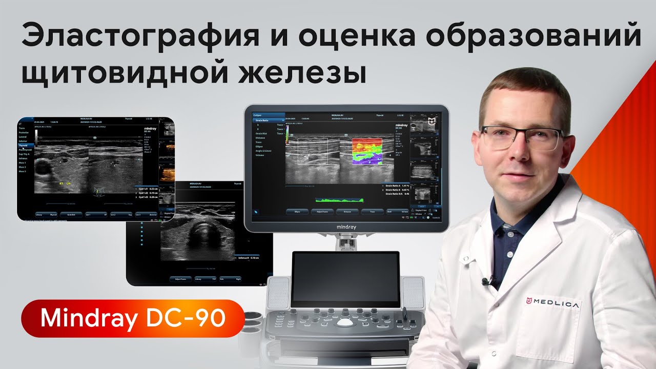 УЗИ щитовидной железы: эластография и оценка образований на Mindray DC-90