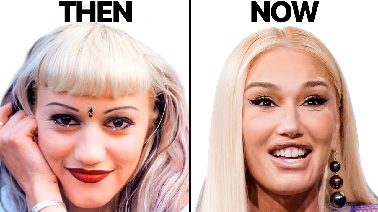 Gwen Stefani NEW FACE | Plastic Surgery Analysis