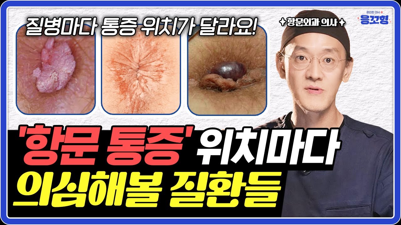 항문이 '여기'가 아프다면 통증 위치를 주목하세요! | 항문 통증 위치별 질환 총정리