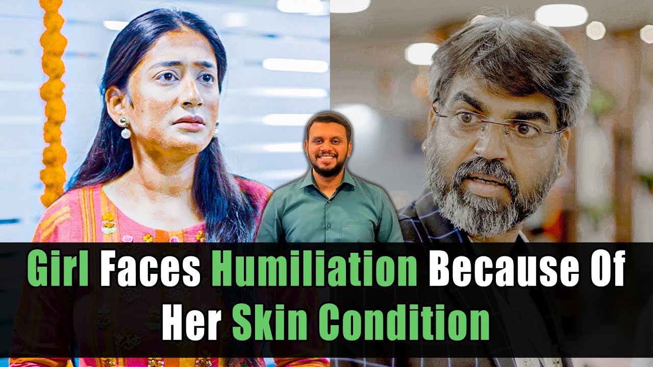Girl Faces Humiliation Because Of Her Skin Condition | Nijo Jonson | Motivational Video