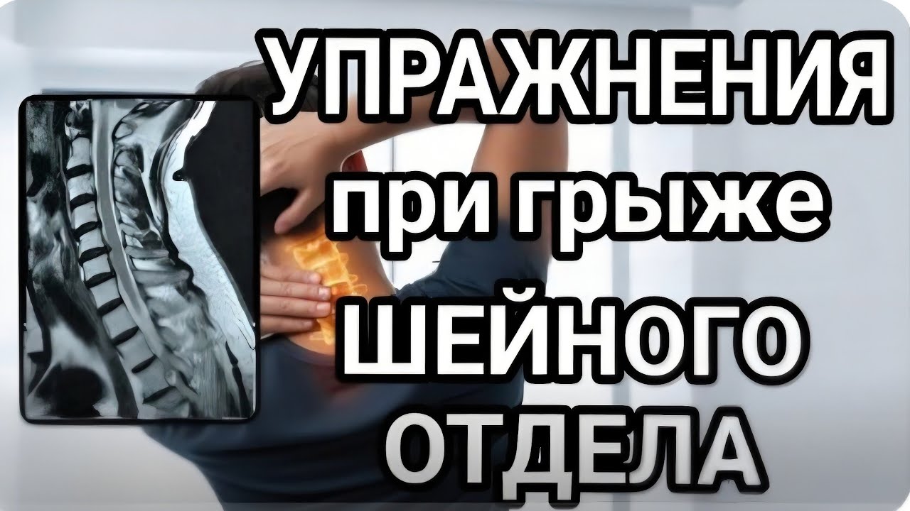 Грыжи шейного отдела позвоночника: упражнения, которые ДЕЙСТВИТЕЛЬНО помогают.