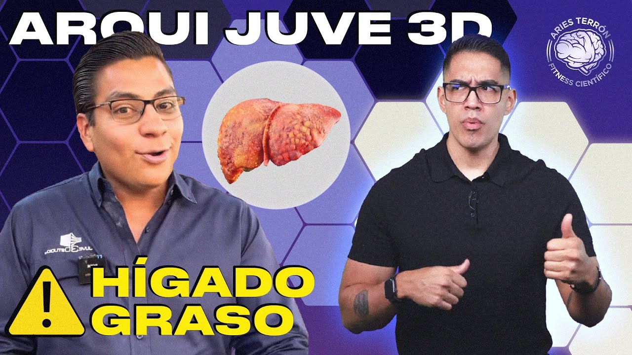 ArquiJuve3D tenía HÍGADO GRASO y no lo sabía ‼️ (caso real)