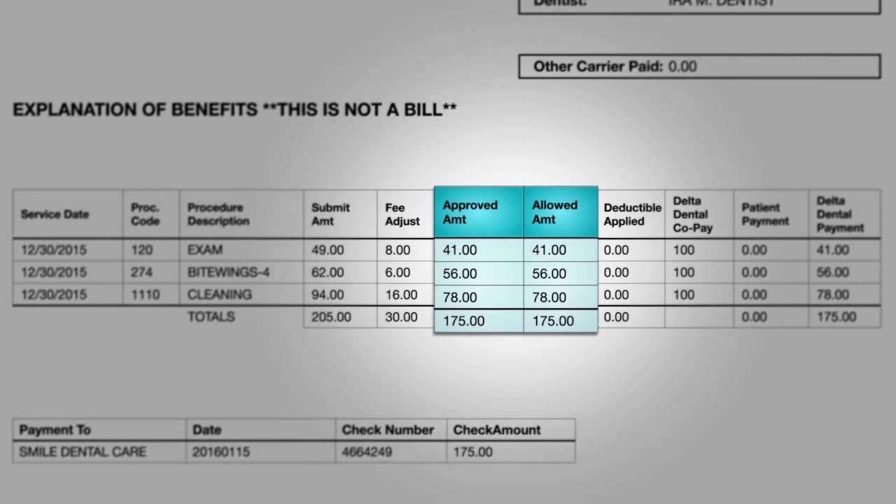 Your Explanation of Benefits, Explained! | Learn More with Delta Dental