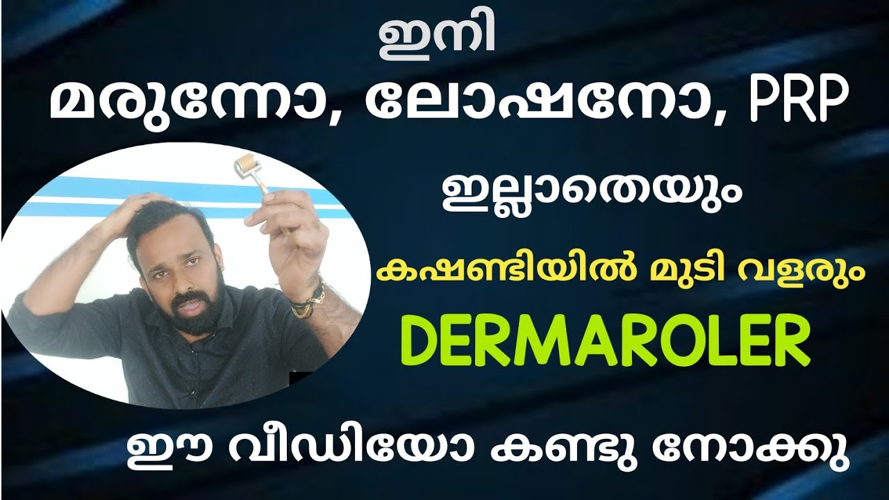ഏത് കഷണ്ടികാർക്ക്,മുടി കൊഴിച്ചിൽ ഉള്ളവർക്കു ഉപയോഗിക്കാം, #Dermarollermalayalam #Dermaroller മലയാളം