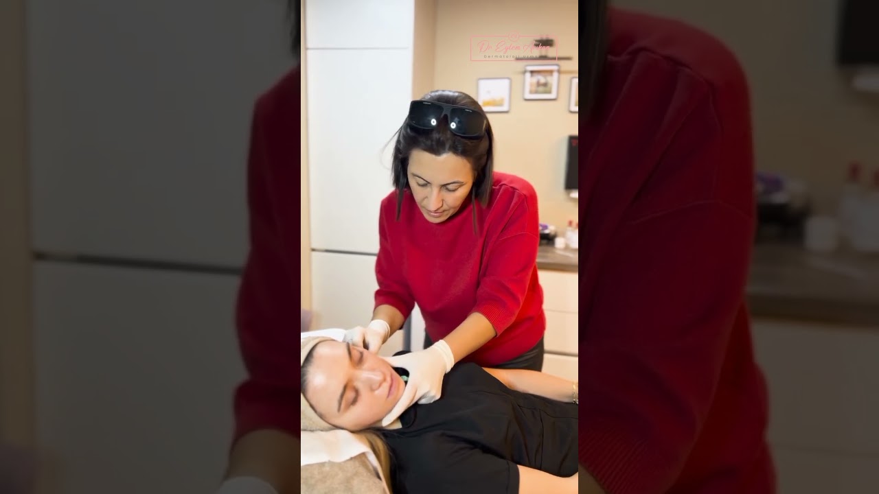 &Ccedil;ukur ve akne izi olan hastalarımda kullandığım &ldquo;Subzisyon İşlemi Uygulaması&rsquo;nı&rdquo; sizler i&ccedil;in...