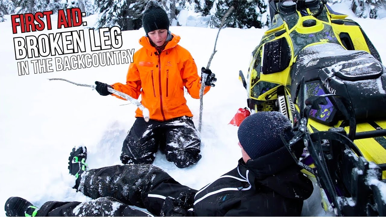 How to Splint a Broken Leg in the Backcountry